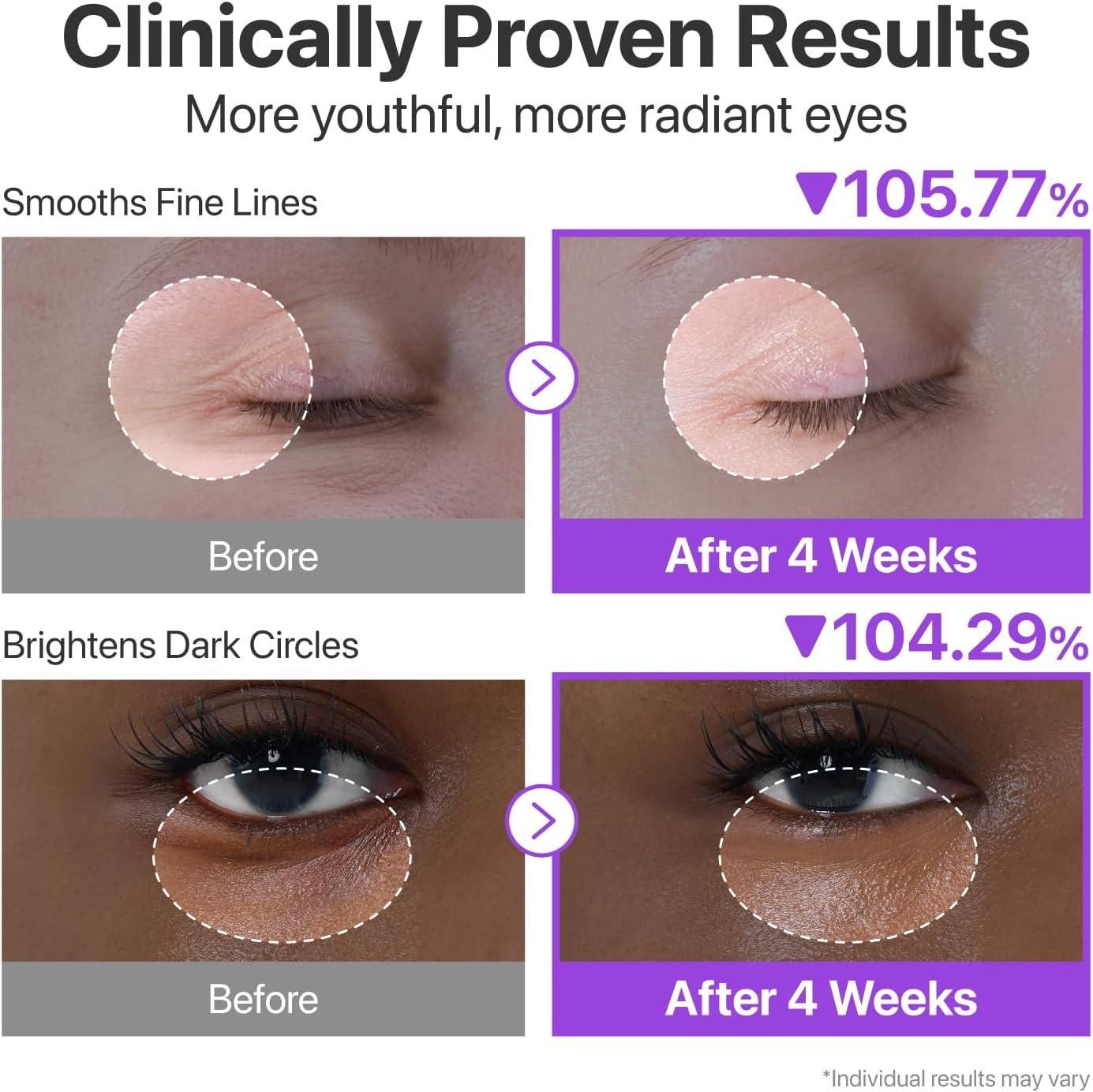 Crème contour des yeux Volumetox 100 g